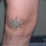 photo star tattoo on his knee 04.01.2019 №013 - photo tattoo ideas - tattoovalue.net