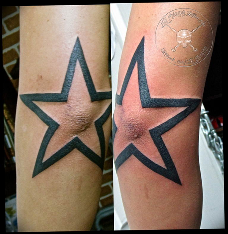 Photo tattoo star on the elbow 19.06.2019 №003 - star tattoo example - tattoovalue.net