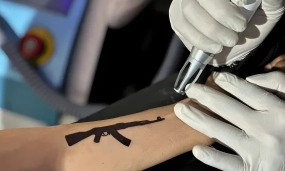 Why Tattoos Are Being Erased Across Kashmir- From Guns to ‘Freedom’ №15 - tattoovalue.net