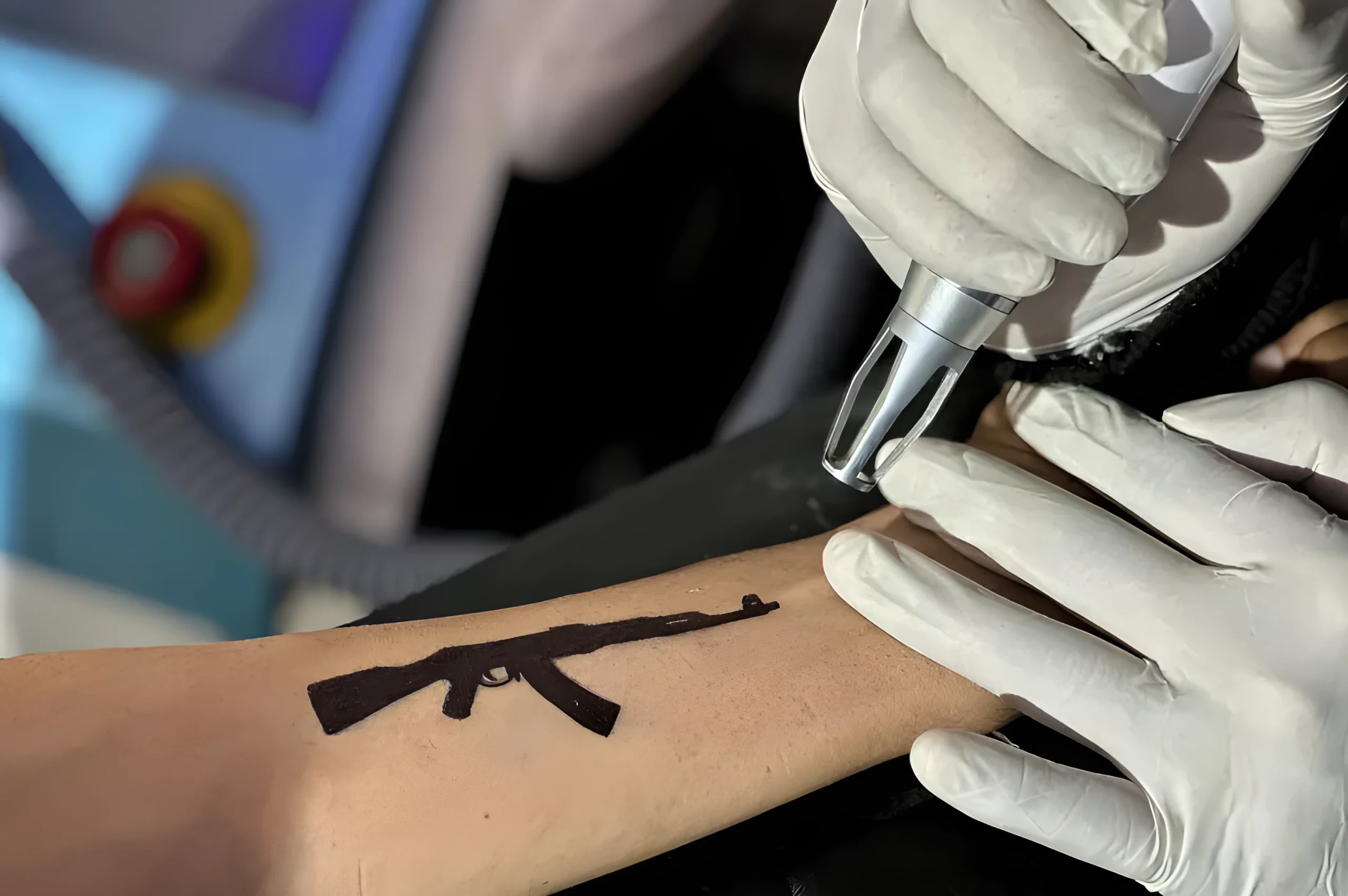 Why Tattoos Are Being Erased Across Kashmir- From Guns to ‘Freedom’ №15 - tattoovalue.net